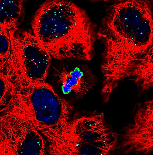 Mitosis_1_edited.jpg
