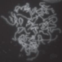 stem cells_edited.png