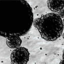 aneuploidy_edited.png